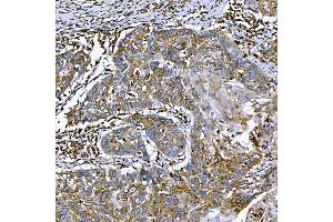 IHC analysis of SEMA4F using anti-SEMA4F antibody (ABIN7601432).