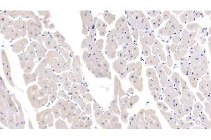Detection of IL13 in Porcine Cardiac Muscle Tissue using Polyclonal Antibody to Interleukin 13 (IL13)