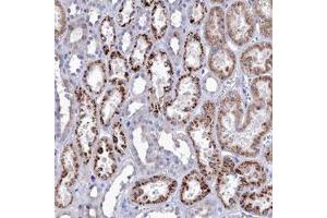 Immunohistochemical staining (Formalin-fixed paraffin-embedded sections) of human kidney with NUDT7 polyclonal antibody  shows strong cytoplasmic positivity in granular pattern in tubular cells. (NUDT7 anticorps)