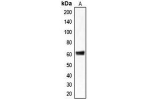 Western blot analysis of CLCC1 expression in HepG2 (A) whole cell lysates. (CLCC1 anticorps  (Center))