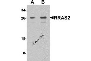 Western Blotting (WB) image for anti-Related RAS Viral (R-Ras) Oncogene Homolog 2 (RRAS2) (C-Term) antibody (ABIN1077448) (RRAS2 anticorps  (C-Term))