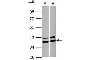 WB Image Sample (30 ug of whole cell lysate) A: A549 B: HepG2 10% SDS PAGE antibody diluted at 1:1000 (AKR1A1 anticorps)