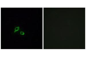 Immunofluorescence analysis of MCF-7 cells, using GIPR antibody. (GIPR anticorps  (Internal Region))