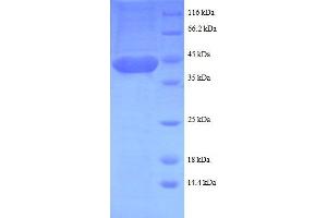 SDS-PAGE (SDS) image for LIM Domain Only 1 (Rhombotin 1) (LMO1) (AA 5-156), (partial) protein (GST tag) (ABIN1047608)