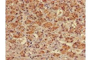 Immunohistochemistry of paraffin-embedded human adrenal gland tissue using ABIN7174961 at dilution of 1:100 (Myosin VIIA anticorps  (AA 838-968))