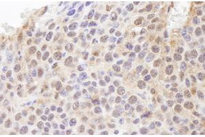 Immunohistochemistry (IHC) image for anti-Ubiquitin (Ub) (AA 1-50) antibody (ABIN7448849) (Ubiquitin anticorps  (AA 1-50))