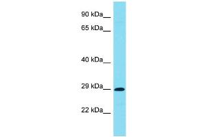 Host: Rabbit Target Name: C7orf57 Sample Type: Jurkat Whole Cell lysates Antibody Dilution: 1. (C7ORF57 anticorps  (C-Term))