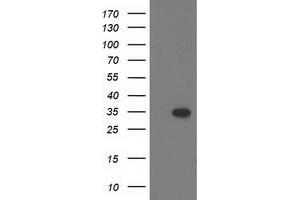 Image no. 1 for anti-CTD (Carboxy-terminal Domain, RNA Polymerase II, Polypeptide A) Small Phosphatase 1 (CTDSP1) antibody (ABIN1497677)