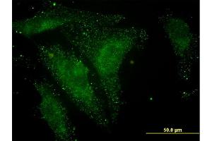 Immunofluorescence of monoclonal antibody to NELL1 on HeLa cell.