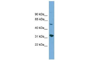 WB Suggested Anti-YIPF2 Antibody Titration:  0. (YIPF2 anticorps  (Middle Region))