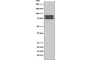 Western blot analysis of FOXP1 expression in Daudi cell lysate.
