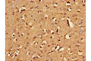 Immunohistochemistry of paraffin-embedded human brain tissue using ABIN7154332 at dilution of 1:100