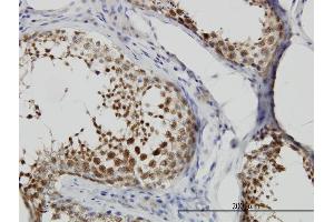 Immunoperoxidase of monoclonal antibody to CSE1L on formalin-fixed paraffin-embedded human testis. (Exportin 2 anticorps  (AA 872-971))