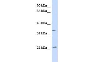 WB Suggested Anti-ARF1 Antibody Titration: 1. (ARF1 anticorps  (Middle Region))