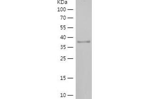 Western Blotting (WB) image for Ribonuclease P/MRP 21kDa Subunit (RPP21) (AA 96-154) protein (His-IF2DI Tag) (ABIN7124871)