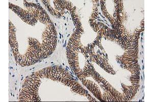 Image no. 2 for anti-Catenin (Cadherin-Associated Protein), beta 1, 88kDa (CTNNB1) antibody (ABIN1496888)
