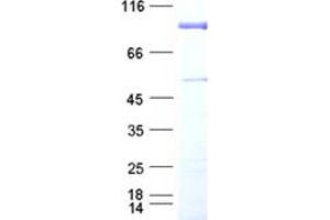 Validation with Western Blot
