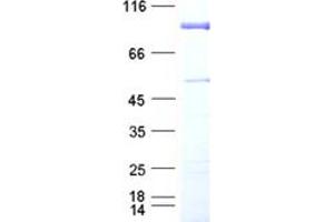 Validation with Western Blot (KAT2B Protein (DYKDDDDK Tag))