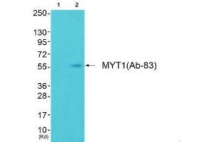 Western Blotting (WB) image for anti-Myelin Transcription Factor 1 (MYT1) (Ser83) antibody (ABIN1848243) (MYT1 anticorps  (Ser83))