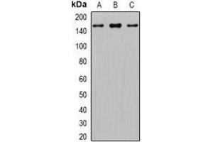 Western blot analysis of GLI1 expression in PC3 (A), mouse brain (B), rat brain (C) whole cell lysates. (GLI1 anticorps)
