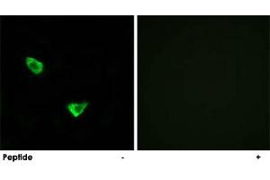 Immunofluorescence analysis of MCF-7 cells, using CHPF polyclonal antibody . (CHPF anticorps)