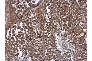 IHC-P Image NPR-C antibody [N3C3] detects NPR-C protein at cell membrane and cytoplasm in mouse testis by immunohistochemical analysis. (NPR3 anticorps)