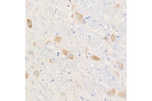 Immunohistochemistry of paraffin-embedded rat brain using  Rabbit mAb (ABIN7265424) at dilution of 1:1000 (40x lens).