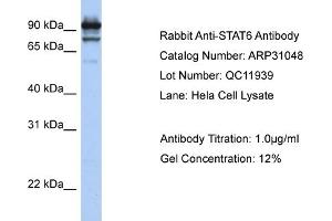WB Suggested Anti-STAT6 Antibody Titration:  1 ug/ml  Positive Control:  Hela cell lysate STAT6 is strongly supported by BioGPS gene expression data to be expressed in Human HeLa cells (STAT6 anticorps  (C-Term))