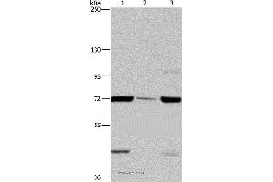Western blot analysis of LoVo cell, human testis tissue and A549 cell, using FAAH Polyclonal Antibody at dilution of 1:400