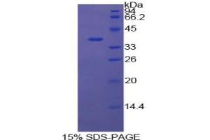 SDS-PAGE analysis of Cow Annexin V Protein. (Annexin V Protéine)