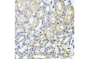 Immunohistochemistry of paraffin-embedded mouse kidney using ST8SIA2 antibody. (ST8SIA2 anticorps  (AA 24-160))