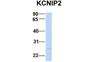 Host:  Rabbit  Target Name:  KCNIP2  Sample Type:  Human Fetal Brain  Antibody Dilution:  1. (KCNIP2 anticorps  (N-Term))