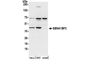 anti-EBNA1 Binding Protein 2 (EBNA1BP2) (AA 256-306) antibody