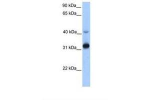 anti-Trans-2,3-Enoyl-CoA Reductase (TECR) (AA 110-159) antibody