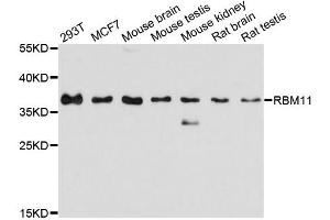 Western blot analysis of extracts of various cell lines, using RBM11 antibody. (RBM11 anticorps)