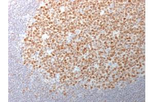 Formalin-fixed, paraffin-embedded human Tonsil stained with BCL-6 Mouse Monoclonal Antibody (BCL6/1982).