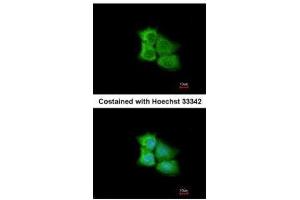 ICC/IF Image Immunofluorescence analysis of methanol-fixed A431, using PCMT1, antibody at 1:200 dilution. (PCMT1 anticorps)