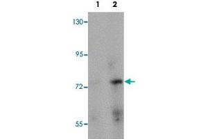 Western blot analysis of rat brain tissue with PIAS2 polyclonal antibody  at (Lane 1) 1 and (Lane 2) 2 ug/mL dilution. (PIAS2 anticorps  (N-Term))