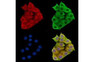 ABIN7096106 and ABIN7100168 staining Hela cells by IF/ICC.
