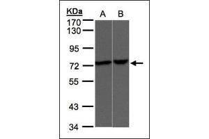 Sample (30 µg of whole cell lysate).