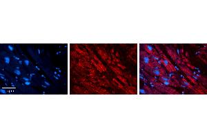 Rabbit Anti-DBI Antibody   Formalin Fixed Paraffin Embedded Tissue: Human heart Tissue Observed Staining: Cytoplasmic Primary Antibody Concentration: 1:100 Other Working Concentrations: 1:600 Secondary Antibody: Donkey anti-Rabbit-Cy3 Secondary Antibody Concentration: 1:200 Magnification: 20X Exposure Time: 0. (Diazepam Binding Inhibitor anticorps  (N-Term))