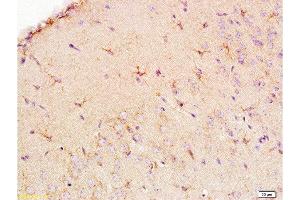 Formalin-fixed and paraffin embedded: rat brain tissue labeled with Anti-EAAT1/GLAST Polyclonal Antibody , Unconjugated at 1:200, followed by conjugation to the secondary antibody and DAB staining (SLC1A3 anticorps  (AA 301-400))