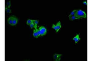Immunofluorescence staining of HepG2 cells with ABIN7158146 at 1:333, counter-stained with DAPI. (LRRC19 anticorps  (AA 25-270))