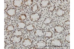 Immunoperoxidase of monoclonal antibody to QARS on formalin-fixed paraffin-embedded human colon.