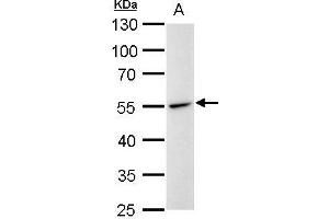 WB Image Desmin antibody detects Desmin protein by western blot analysis.