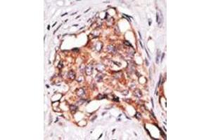 Image no. 2 for anti-Growth Differentiation Factor 3 (GDF3) (N-Term) antibody (ABIN357459) (GDF3 anticorps  (N-Term))