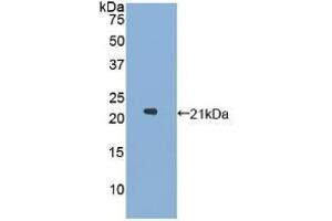WB of Protein Standard: different control antibodies against Highly purified E. (GAA Kit ELISA)