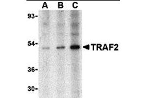 Western Blotting (WB) image for anti-TNF Receptor-Associated Factor 2 (TRAF2) (N-Term) antibody (ABIN1031639) (TRAF2 anticorps  (N-Term))