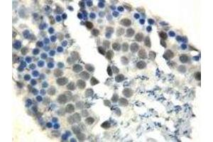 Image no. 1 for anti-DNA Repair Protein Homolog 1 (RAD51) (N-Term) antibody (ABIN1495062)