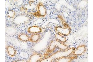 ABIN6256521 and ABIN6267628 at 1/100 staining human normal kidney tissue by IHC-P. (FOXO1 anticorps  (pan, pThr24, pThr32))